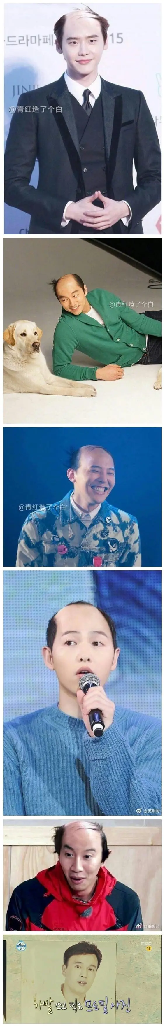 나이먹을수록 두피관리가 중요한이유