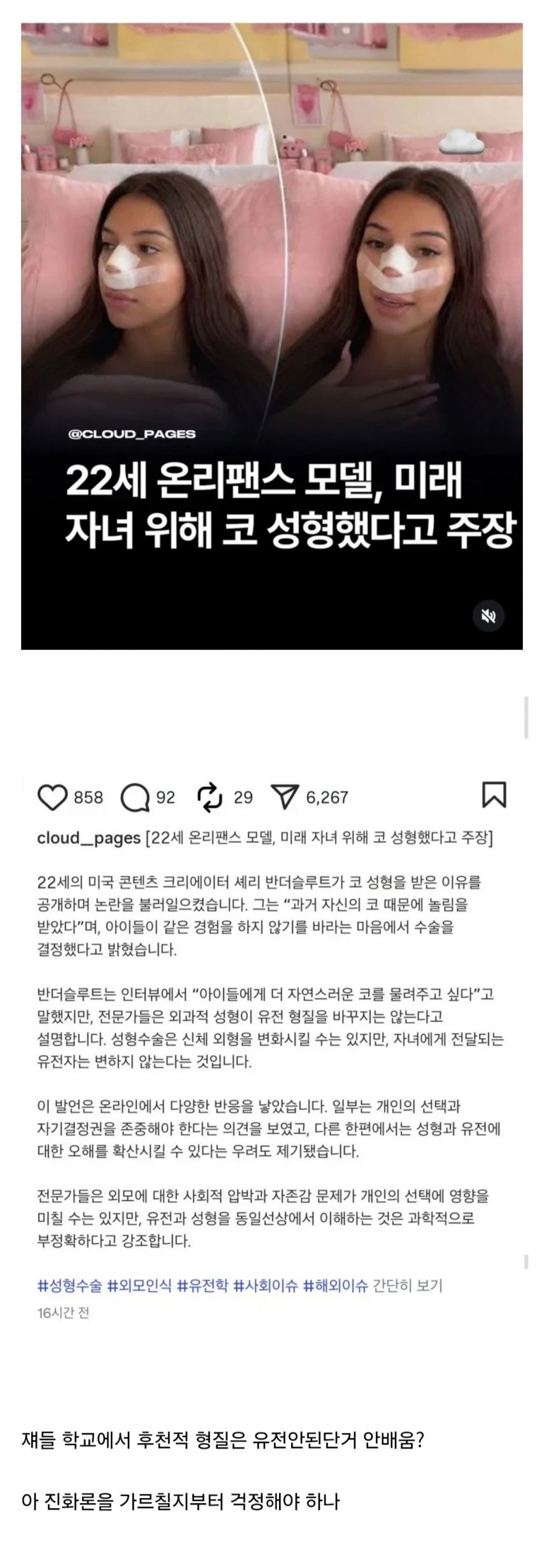 온리팬스 모델 : 미래의 자손들을 위해 코성형했다.jpg