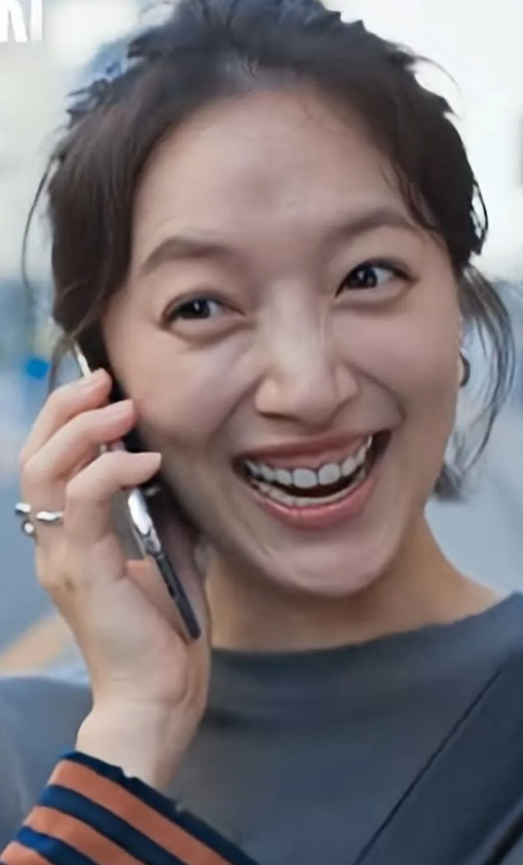 ' 잇몸' 으로 이슈몰이중인 여배우