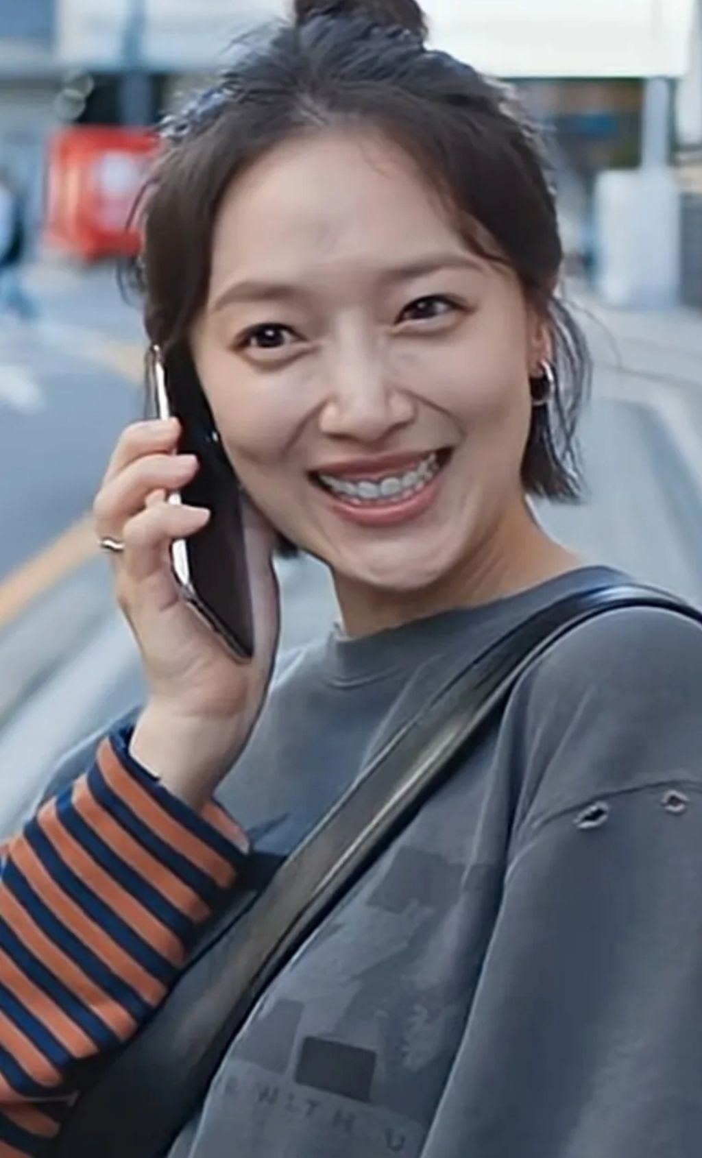 ' 잇몸' 으로 이슈몰이중인 여배우
