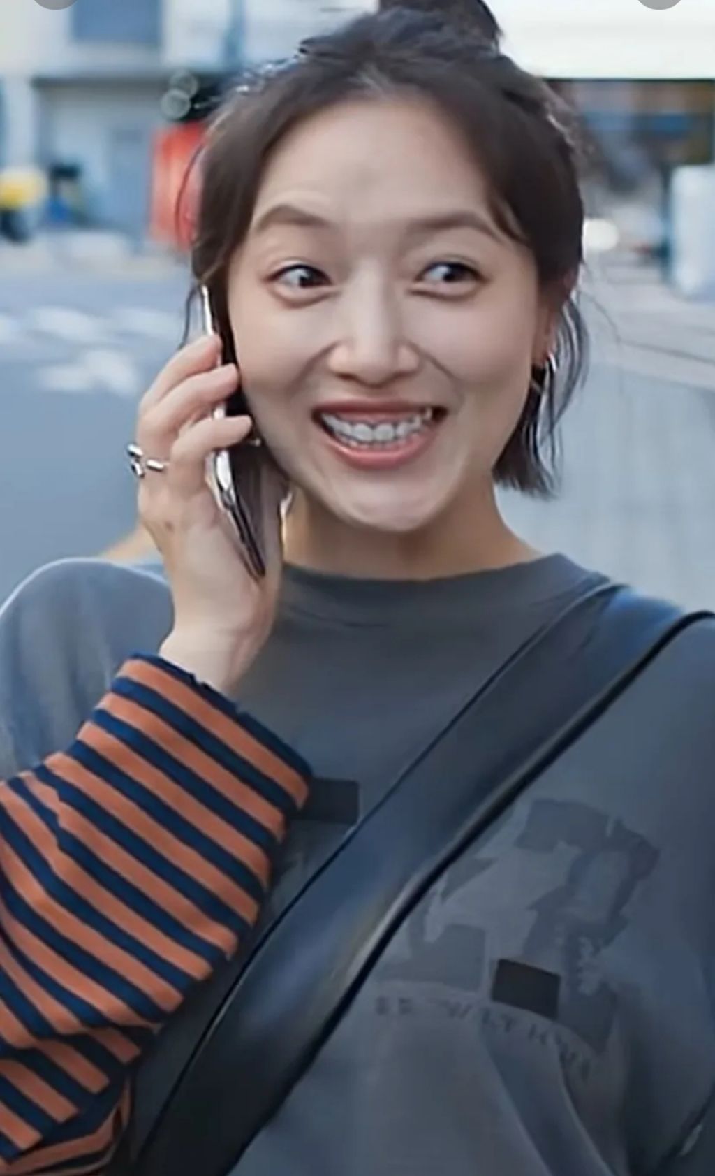 ' 잇몸' 으로 이슈몰이중인 여배우